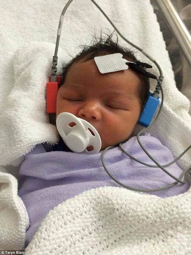 Mωρό με απώλεια ακοής, ακούει τη μητέρα του για πρώτη φορά