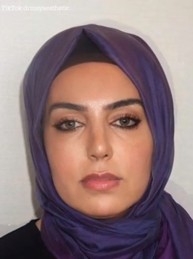 πλαστικη_επεμβαση