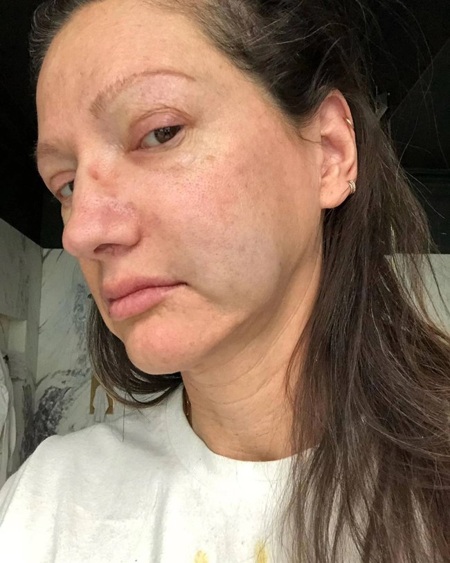 Jenna Lyons: "Όλα μου τα δόντια είναι ψεύτικα, τα μαλλιά μου είναι ψεύτικα, οι βλεφαρίδες μου είναι ψεύτικες, δεν έχω φρύδια, έχω επίσης σημάδια σε όλο μου το δέρμα".