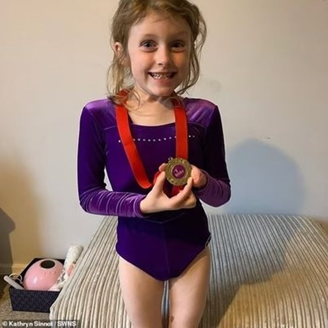 Επτάχρονο κορίτσι που γεννήθηκε χωρίς δάχτυλα στο αριστερό της χέρι ονειρεύεται να γίνει επαγγελματίας γυμνάστρια - Και αρνείται να χρησιμοποιήσει προσθετική