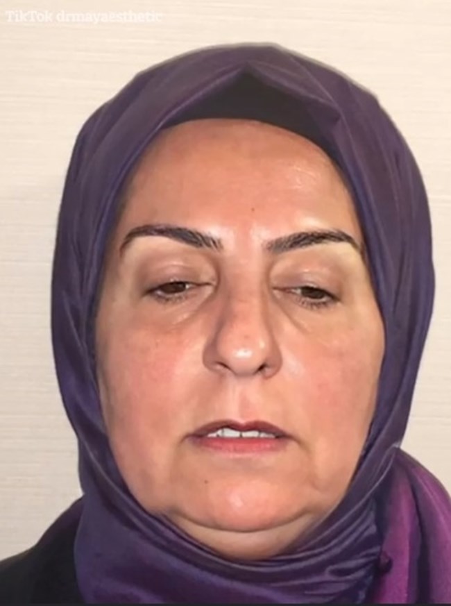 H ολική μεταμόρφωση της 68χρονης Ντιλέκ