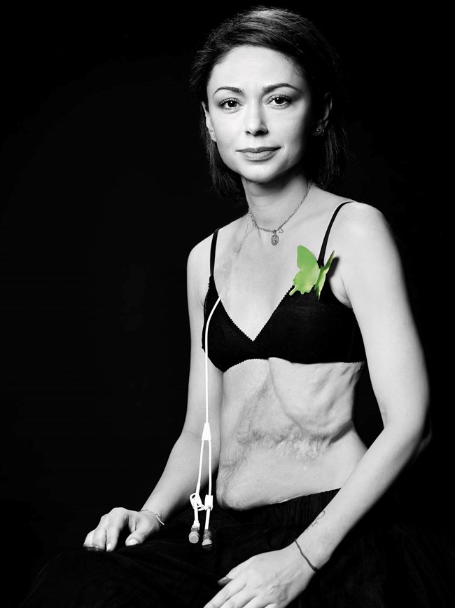 Πανελλήνια Ημέρα Δωρεάς Οργάνων: "Η δωρεά οργάνων είναι ένα ανεκτίμητο δώρο, η υπέρτατη πράξη αλληλεγγύης".