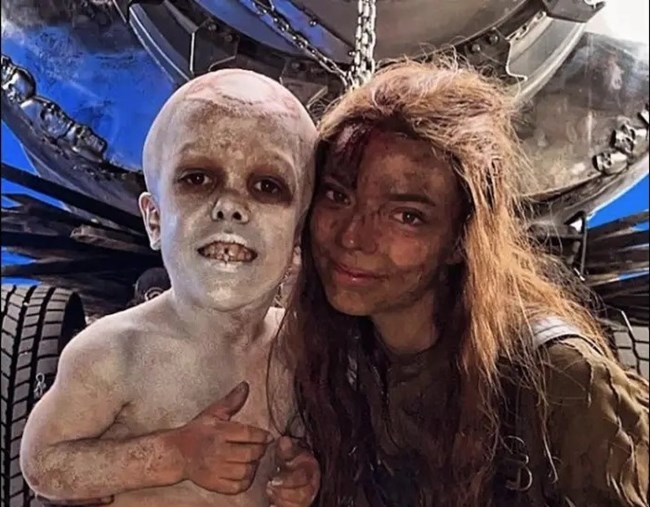 Πρωταγωνιστής στην ταινία "Furiosa: A Mad Max Saga" το αγόρι με νανισμό που δεχόταν ακραίο bullying στο σχολείο