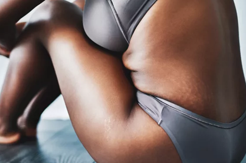 Love your body: Πώς θα βελτιώσεις τη σχέση σου με το σώμα σου