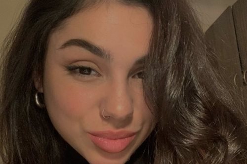 Θεσσαλονίκη| Έκλεψαν το πορτοφόλι της 21χρονης κοπέλα ενώ ήταν αιμόφυρτη στον δρόμο