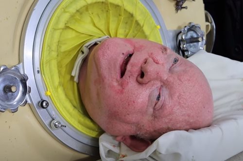 Γνωρίστε τον άντρα που ζει 70 χρόνια σε μεταλλική αναπνευστική συσκευή