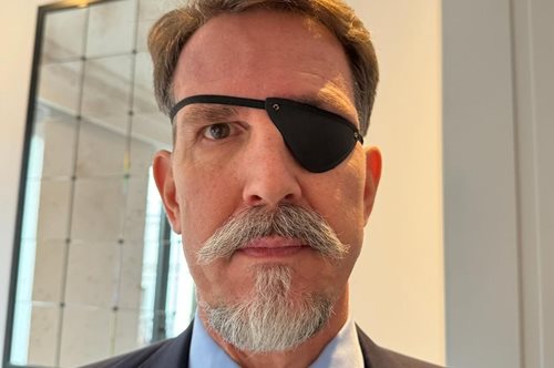 Παύλος Γλύξμπουργκ: Αποκάλυψε γιατί φοράει το μαύρο κάλυμμα στο μάτι