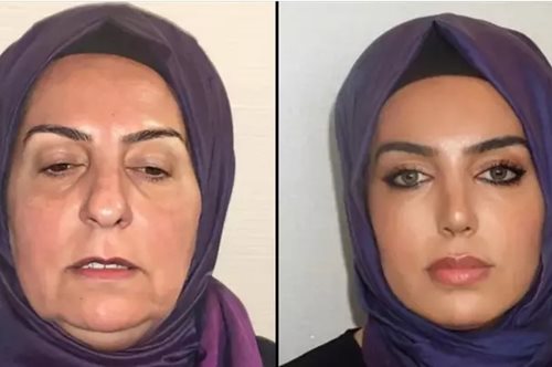 H ολική μεταμόρφωση της 68χρονης Ντιλέκ