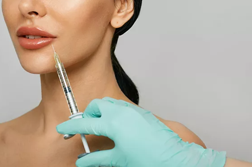 Fillers χειλιών: Ρωτήσαμε την ειδικό όλα όσα πρέπει να ξέρεις