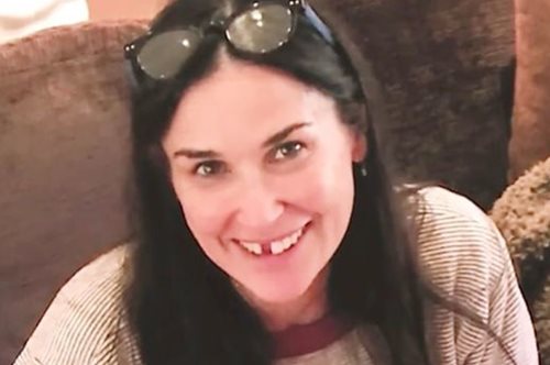 Έπεσαν τα δύο μπροστινά δόντια της Ντέμι Μουρ 