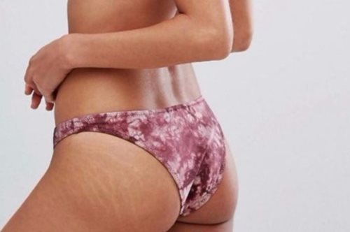 Τέλος η πλαστή τελειότητα. Δείτε πώς είναι πραγματικά τα μοντέλα του ASOS