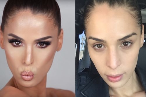 Άνθρωποι δοκιμάζουν την 5λεπτη επέμβαση αντί για πλαστική στη μύτη και ξεσπούν σε δάκρυα χαράς 