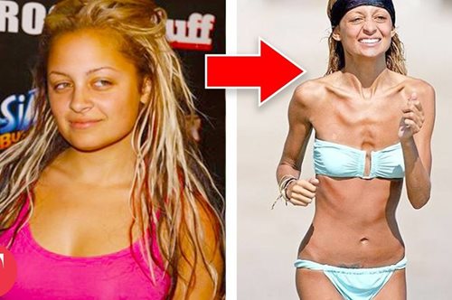 Σοκαριστική μεταμόρφωση: 10 διάσημοι που έχασαν βάρος αλλάζοντας εντελώς την εικόνα τους