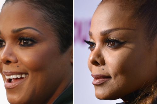 Έπαθε Μάικλ Τζάκσον. Η Τζάνετ εμφανίστηκε σε επίσημη εκδήλωση με πεσμένη μύτη