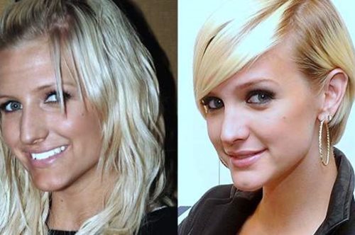 Κι όμως άλλαξαν: 9 διάσημοι που έκαναν ρινοπλαστική και μεταμόρφωσαν το βλέμμα τους