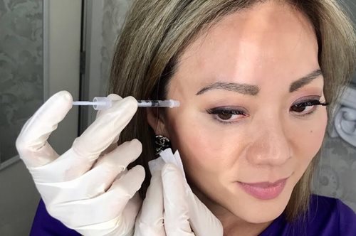 Η γυναίκα που «χτύπαγε» μπότοξ μόνη της στο πρόσωπό της γιατί δεν εμπιστευόταν κανέναν