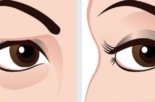 Η πρωινή καθημερινή ρουτίνα που θα ανεβάσει στα ύψη τα πεσμένα σας βλέφαρα
