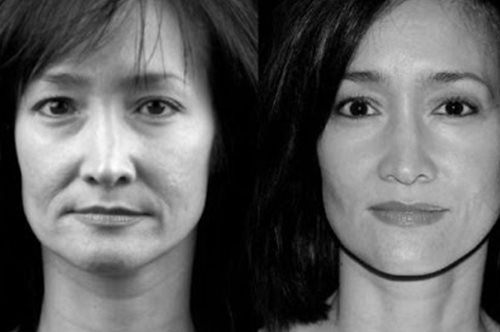 Απόλυτη μεταμόρφωση: Κάνε lifting στο πρόσωπό σου με ειδικές ασκήσεις και ένα κουτάλι  