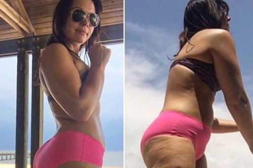 Mία fitness blogger δείχνει τα πόδια της στο Instagram έτσι όπως τα κακοφωτίζει ο ήλιος