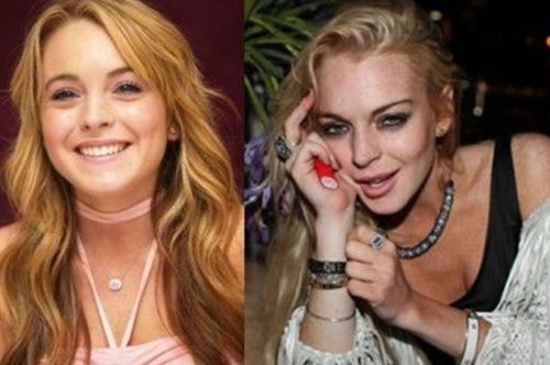 14 διάσημοι πριν και μετά τον εθισμό στα ναρκωτικά