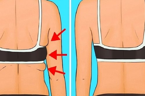 Διώξε την πλαδαρή πλάτη. 7 ασκήσεις που αλλάζουν τελείως το επίμαχο σημείο μέσα σε μόλις ένα μήνα