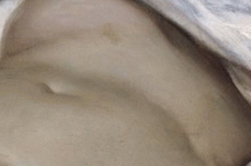 Πίνακας του 1886 με ένα αιδοίο στέλνει το Facebook στα δικαστήρια