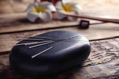 Όλα όσα ήθελες να μάθεις για τον βελονισμό αλλά δεν ήξερες ποιον να ρωτήσεις 