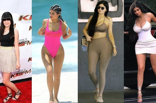 Προσθέσεις κι αφαιρέσεις επιθεμάτων με φόντο δισεκατομμύρια: Η Κάιλι Τζένερ από ενός έως 20 ετών