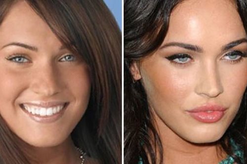 15 πλαστικές διάσημων που λες «μπράβο, αυτές πέτυχαν»