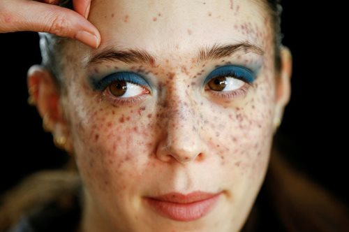 Νεανικό βλέμμα: Το μυστικό των Γιαπωνέζων για να εξαφανίσεις τις ρυτίδες των ματιών σε 1 λεπτό