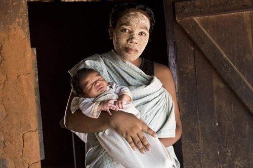 Άλλοτε με μαντζούνια, άλλοτε με σκοινιά. Πώς γεννιούνται τα παιδιά σε διαφορετικές χώρες του κόσμου