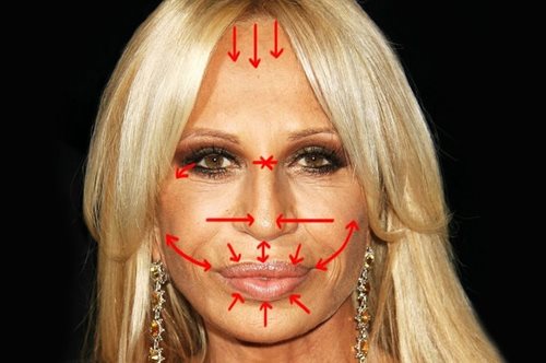 Το μετά από το πριν: Αφαιρώντας τις πλαστικές επεμβάσεις της Ντονατέλα Βερσάτσε 