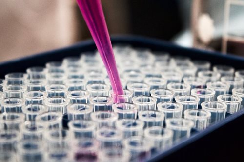 Ωραία νέα: Ο πρώτος Έλληνας ασθενής με μεσογειακή αναιμία που θεραπεύτηκε από τη νόσο