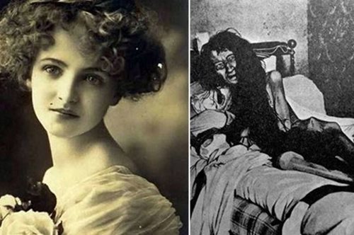 Η τραγική ιστορία της Γαλλίδας που η μητέρα της κράτησε κλειδωμένη στη σοφίτα για 25 χρόνια 