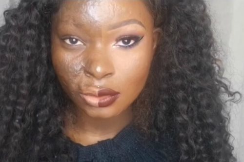 To θαύμα του μακιγιάζ μεταμορφώνει το πρόσωπο μιας γυναίκας που κάηκε στα 9 της χρόνια