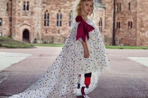 Παγκόσμιος θαυμασμός: 9χρονη με διπλό ακρωτηριασμό στην εβδομάδα μόδας για παιδιά 