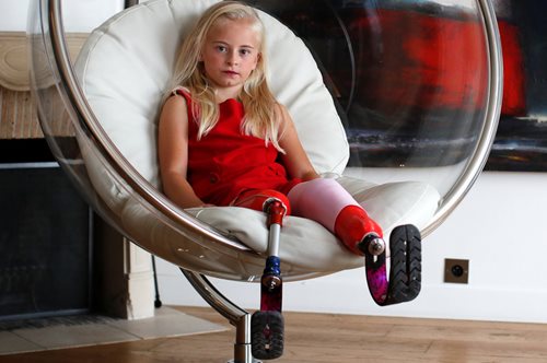 9χρονο μοντέλο με διπλό ακρωτηριασμό: Το πρώτο που θα παρελάσει στην Εβδομάδα Μόδας του Παρισιού