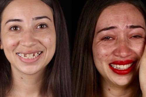 Ο οδοντίατρος που έχει φτιάξει δωρεάν τα δόντια 1.500 απόρων. Χαρίζει ομορφιά, υγεία, αυτοπεποίθηση