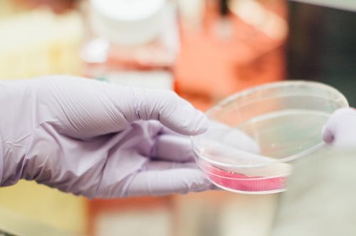 Νέα εξέταση αίματος θα ανιχνεύει τον καρκίνο του μαστού έως και πέντε χρόνια πριν από τα συμπτώματα