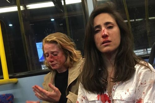 Ομοφοβικό μίσος: Ζευγάρι λεσβιών ξυλοκοπήθηκε άγρια σε λεωφορείο. Μόλις δημοσιοποιήθηκε το βίντεο
