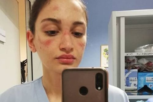 Μία Ιταλίδα νοσοκόμα συγκλονίζει με τη μαρτυρία της: «Οι νέοι δεν έχουμε ανοσία στον ιό»