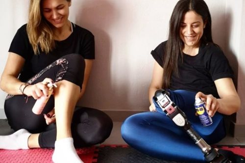 «Πάντα ονειρευόμουν μια Barbie που να με αντιπροσωπεύει»: Η Βάσω Μανουλοπούλου έχει τεχνητό μέλος 