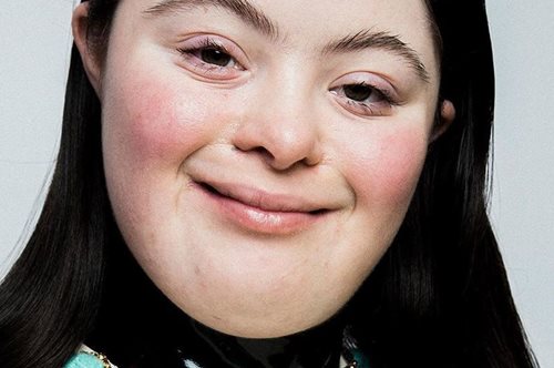 O καλός «θάνατος» του στερεότυπου. Ένα μοντέλο με σύνδρομο Down στη νέα καμπάνια του οίκου Gucci