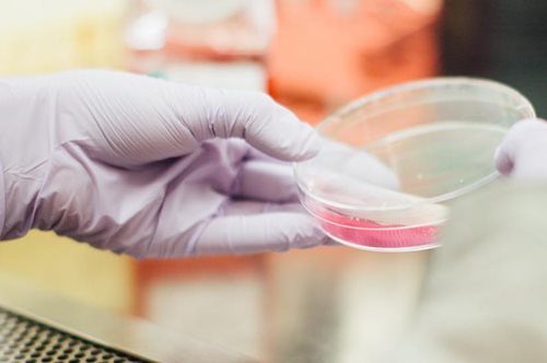 Κόλλησες τον ιό HPV;  Μάθε γιατί δεν αρκεί το τεστ ΠΑΠ