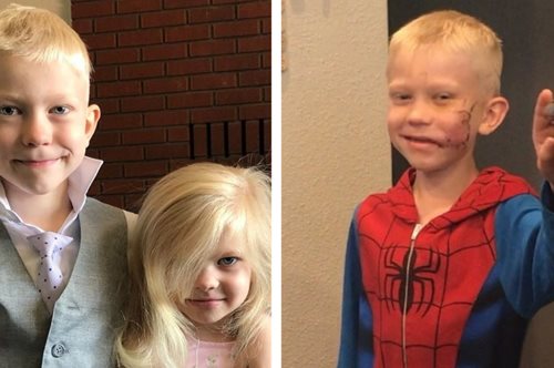 Το 6χρονο αγοράκι που έσωσε την αδερφή του από την επίθεση σκύλου: «Ένας αληθινός σούπερ ήρωας»