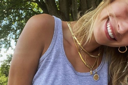 Η Χάλεϊ Μπίμπερ μίλησε για το δερματικό πρόβλημα που αντιμετωπίζει. Ποιο λάθος της το επιδεινώνει