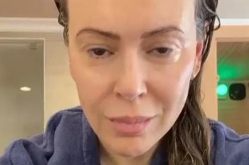 Της έμειναν τα μαλλιά στα χέρια: Η Αλίσα Μιλάνο δείχνει τη δραματική τριχόπτωση μετά τον κορονοϊό