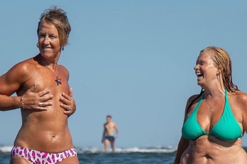 «Το στήθος μου συνταξιοδοτήθηκε πρόωρα»: Τόπλες στην παραλία μετά από διπλή μαστεκτομή 