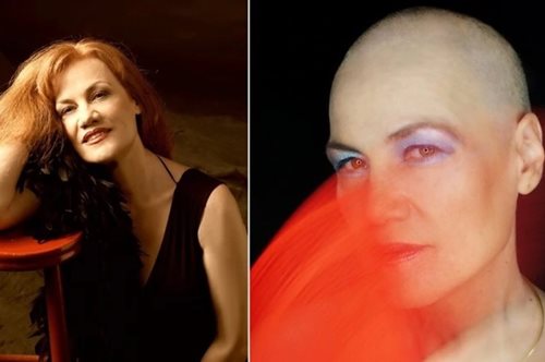 «Η ζωή είναι ωραία»: Η γενναία ανάρτηση της Αθηνάς Παππά για τη μάχη με τον καρκίνο του μαστού