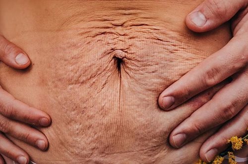 «Το μαλακό, ζαρωμένο δέρμα της κοιλιάς της φιλοξένησε για 18 μήνες τους τρεις καλύτερους φίλους μου»